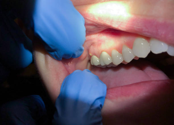Best Cracked Tooth Emergency Dentist  in Chalfont, PA